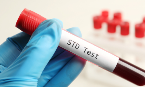 sti testing