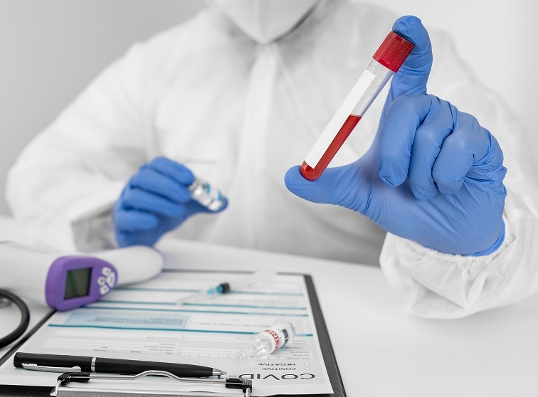 The Importance Of STD Screening