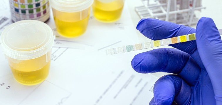 UTI Test And Diagnosis Methods