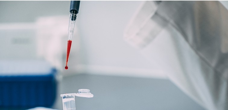 Why Early Detection HIV Matters