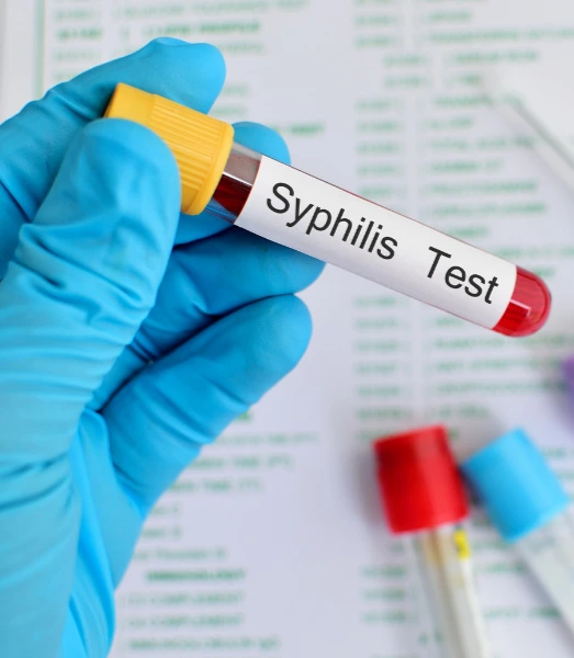Syphilis Test